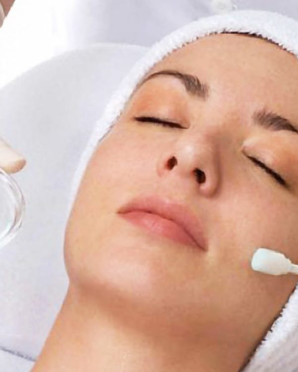 chemical-peel